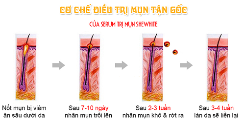 Cơ chế loại bỏ mụn của serum trị mụn Shewhite