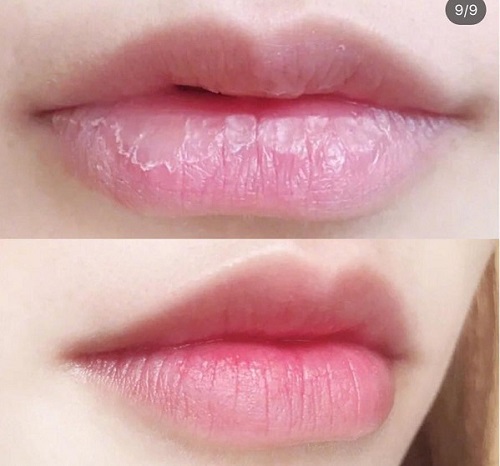 Đôi môi hồng hào căng mịn nhờ son dưỡng trị thâm môi Dhc Lip Cream Nhật Bản