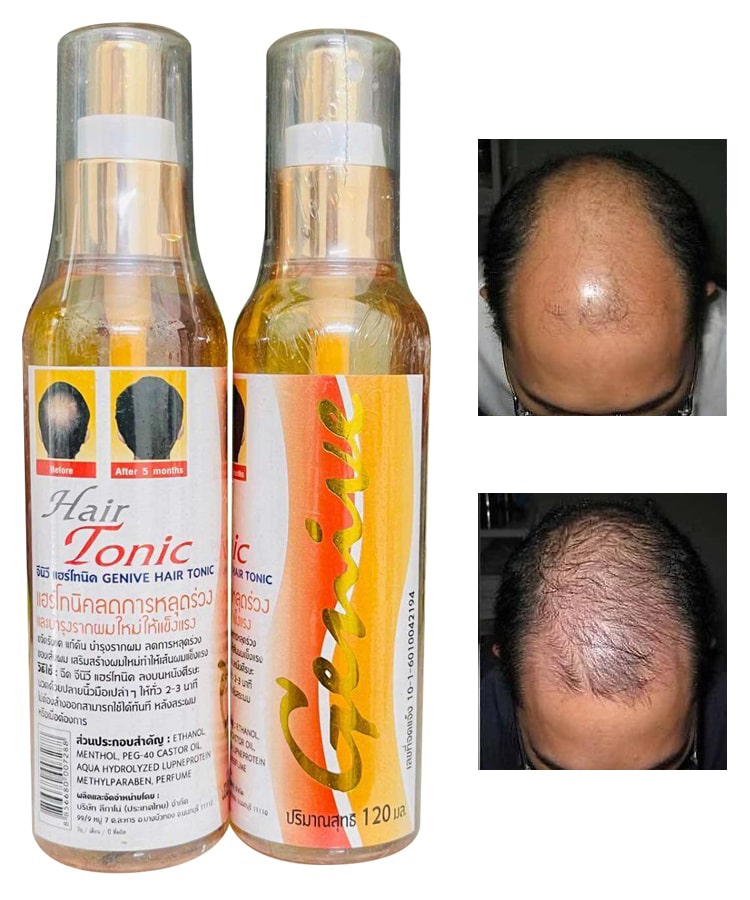 tinh-chat-kich-thich-moc-toc-tri-hoi-dau-hair-tonic-genive-thai-lan